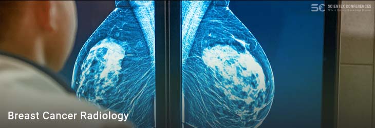 Breast Cancer Radiology