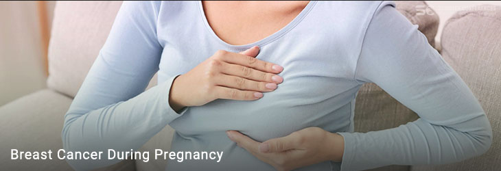 Breast Cancer During Pregnancy 